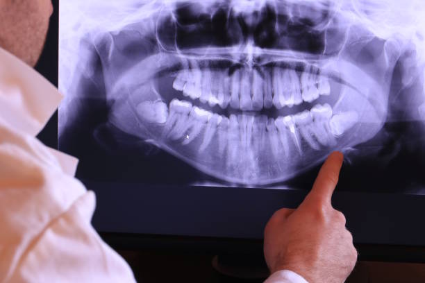 Best Emergency Broken Tooth Repair in New Eagle, PA